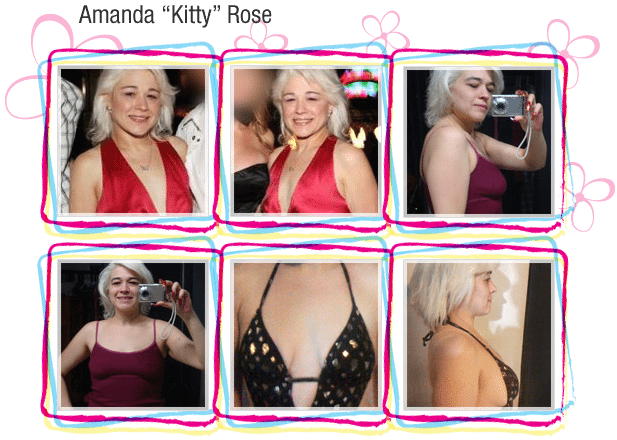 Breast Enlargement Before and after photos of Amanda Kitty Rose