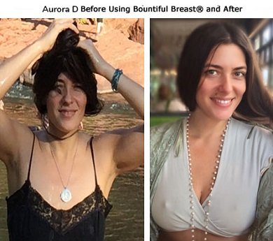 Aurora D Before using Bountiful Breast @After