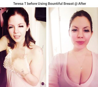 Teresa T. Before using Bountiful Breast @After