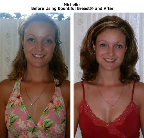 ba michelle enlarged |